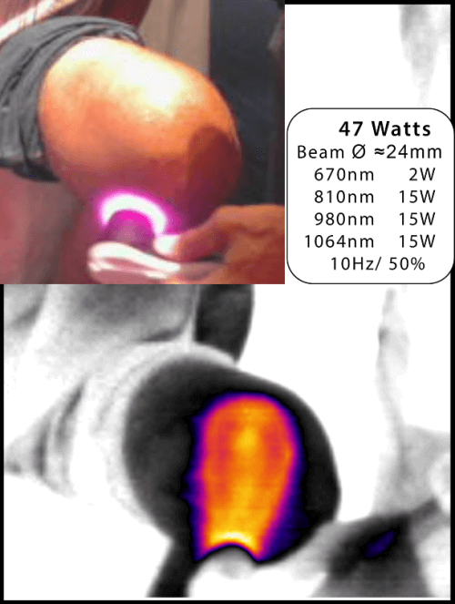 47W Knee