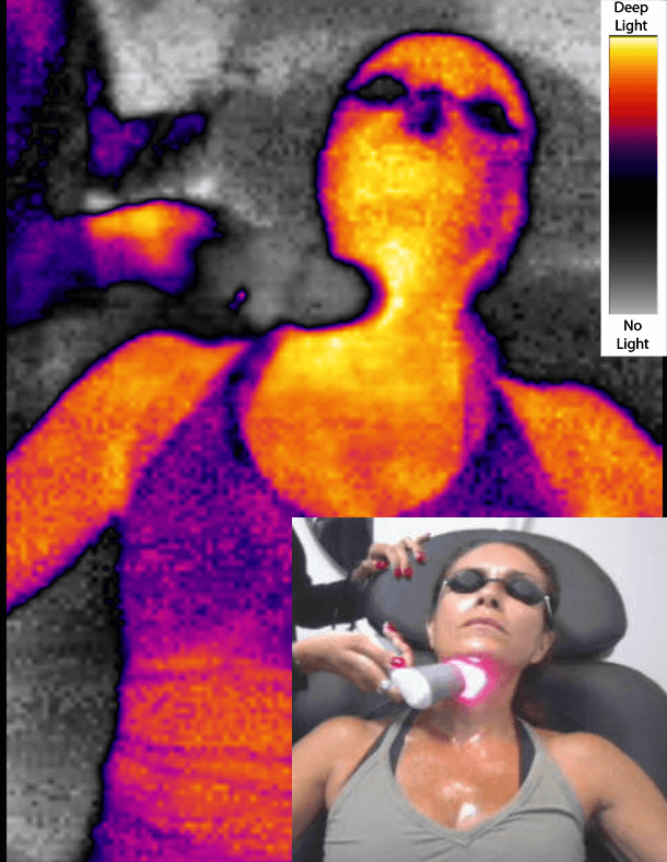 CRT Facial