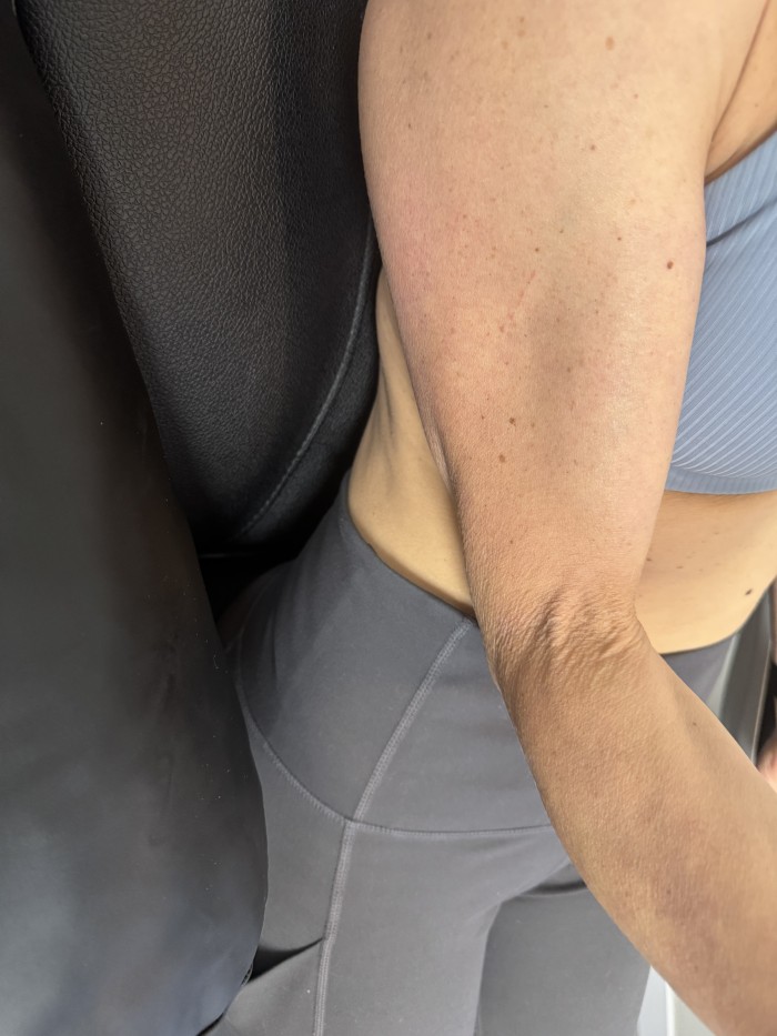 Arm Crape before