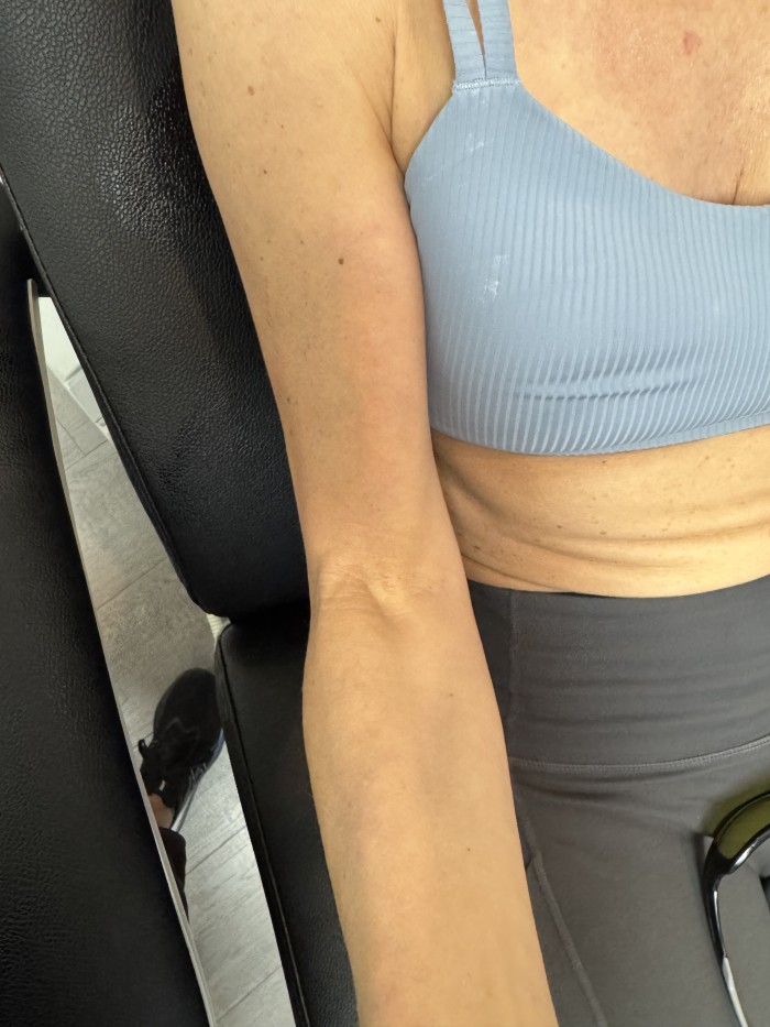 Arm crape after